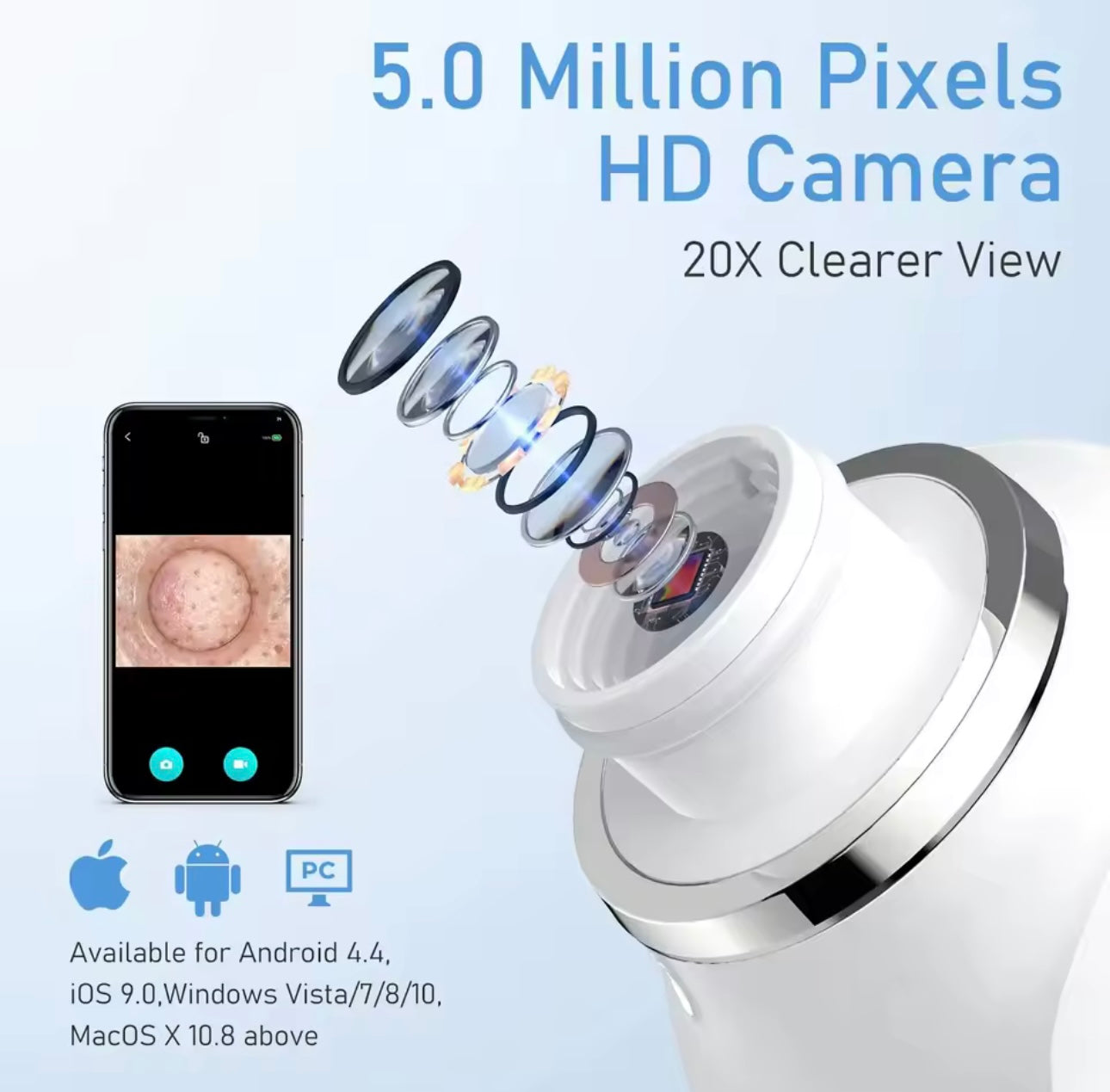 WiFi Visual Blackhead Remover & Pore Vacuum